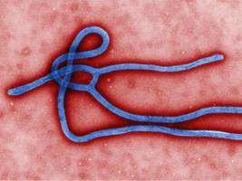 Five Suspected Ebola Victims Found in Albania